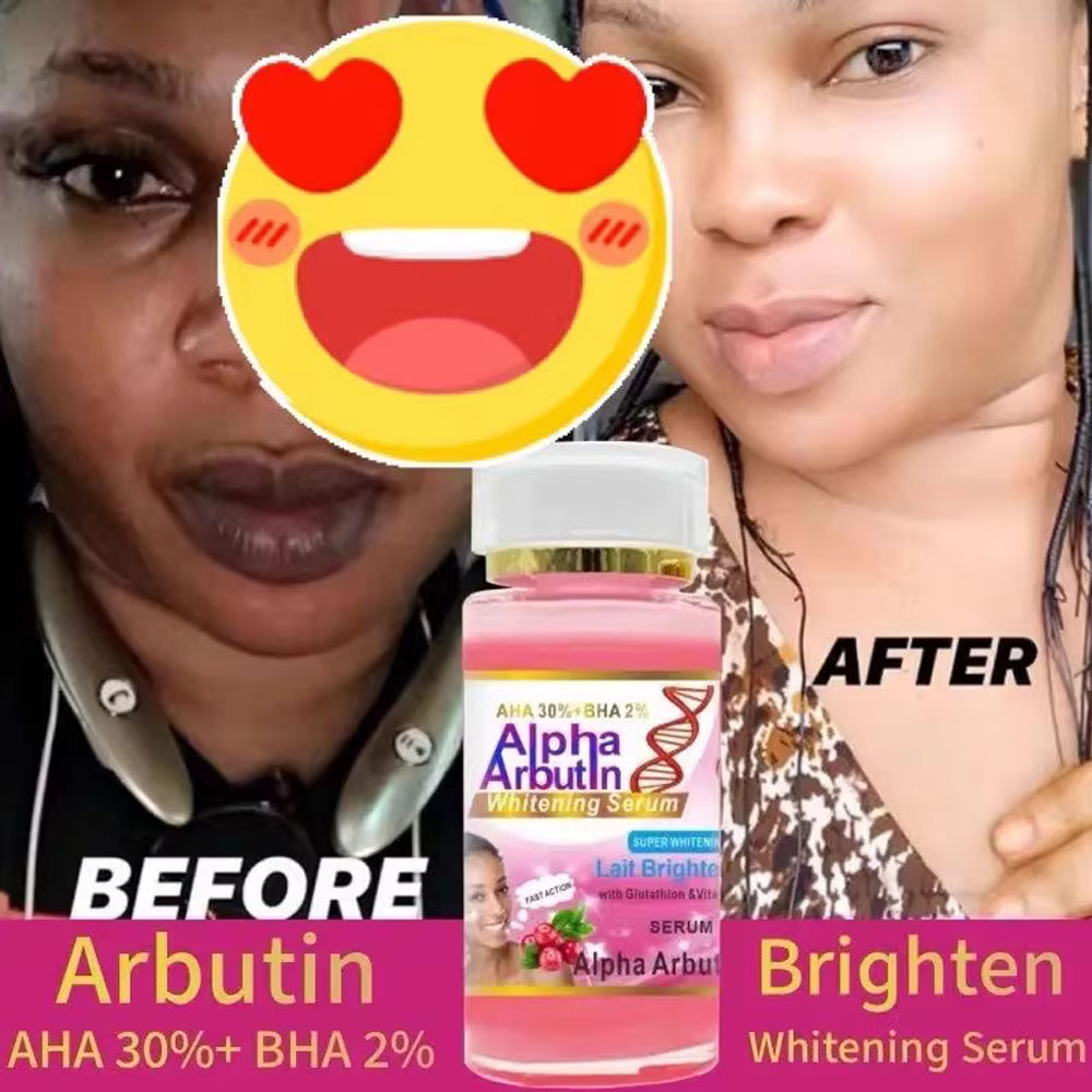 Сыворотка с альфа-арбутином AH – обзор и цена Alpha Arbutin Serum