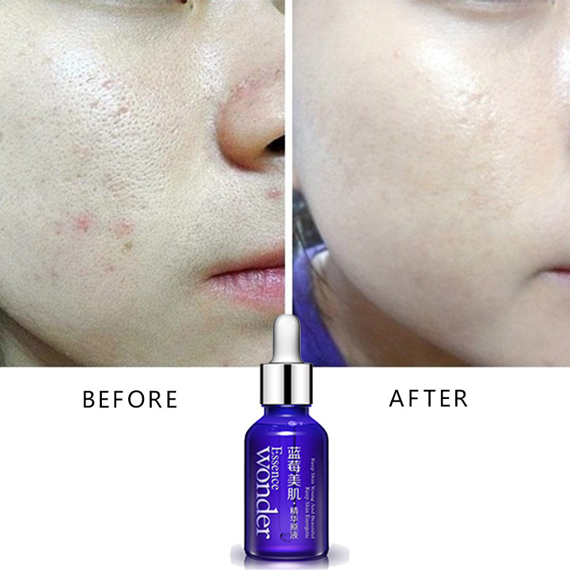 Оригинальная Сыворотка для под – обзор и цена Skincare Bioaqua