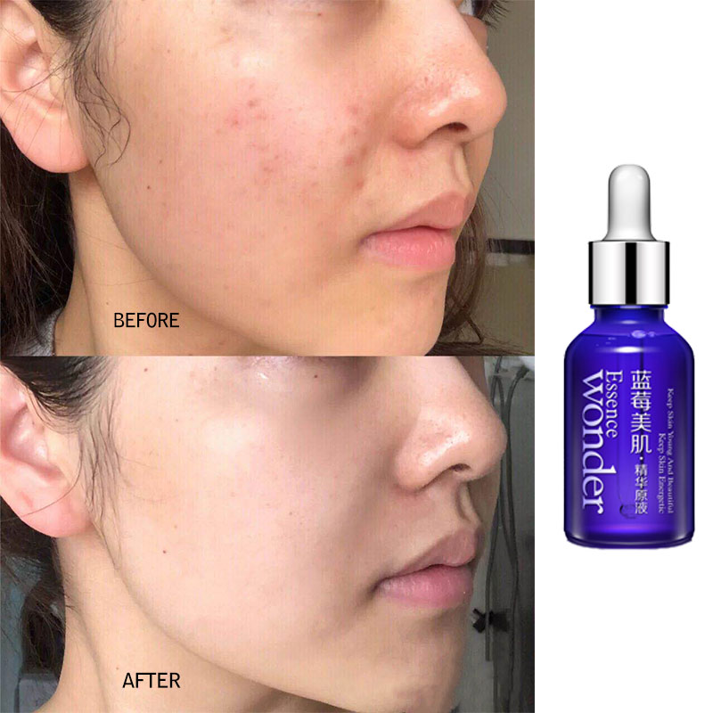 Оригинальная Сыворотка для под – обзор и цена Skincare Bioaqua