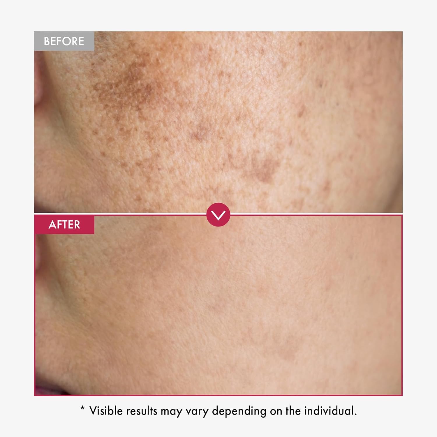 Сыворотка с альфа-арбутином AH – обзор и цена Alpha Arbutin Serum