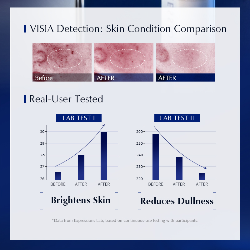 Сыворотка для лица с ниацинами – обзор и цена Alpha Arbutin Serum